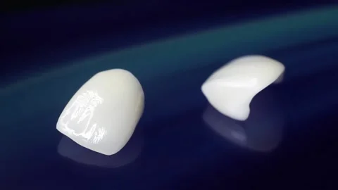 Ceramic dentures and implants dental crowns. Stock Footage 154011838
