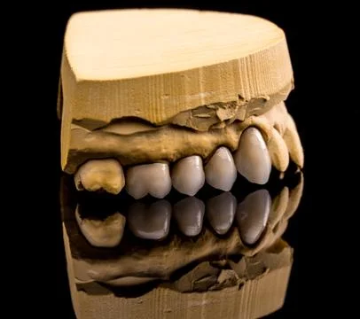 Ceramic dentures Stock Photos