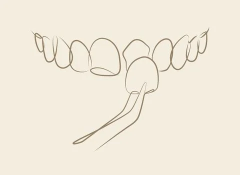 Ceramic veneers installation procedure for teeth silhouette beige Stock Illustration