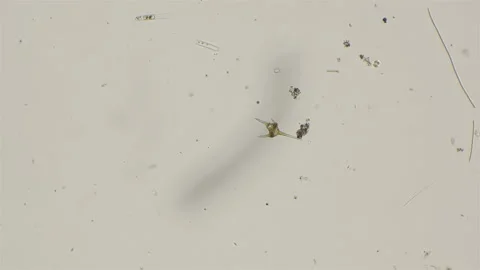 Ceratium unicellular algae, under a microscope Stock Footage 93913451