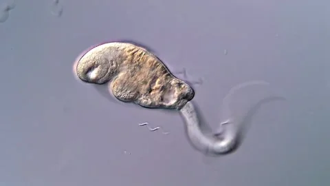 Cercariae Larvae Display under Light Microscope 库存影片 317223737