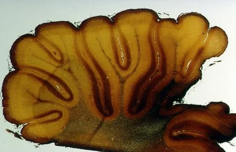 Cerebellum after silvering in longitudinal section under the microscope Stock Photos