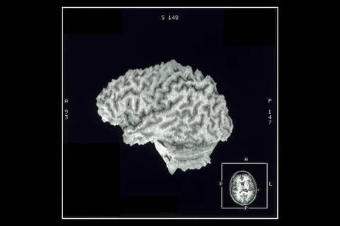  Cerebral cortex, mri Normal cerebral cortex, left lateral view. 3D recons... Stock Photos