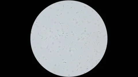 Cerebratulus worm sperm under microscope, Nemertea Phylum, Family Lineidae Stock Footage 202627051