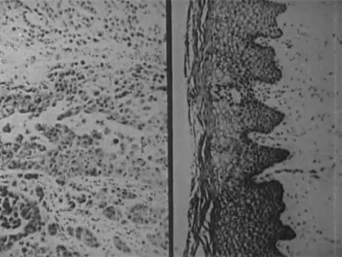 Certain environmental elements can heighten the risk of cancer, but scientists Video stock 74946360