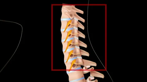 Cervical medial branch block Video stock 37929751