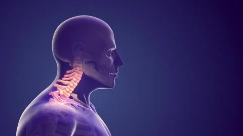 Cervical posture syndrome or neck discomfort Stock Footage 244152204