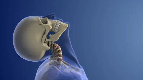 Cervical Whiplash Trauma Causing Neck Strain Stock Footage 307315547