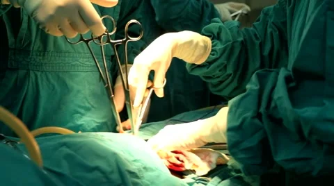 Cesarean section in hospital Stock Footage 44728270
