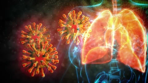 Cg medicine 3D animation, human lungs problems of 2019-ncov Stock Footage 168028908