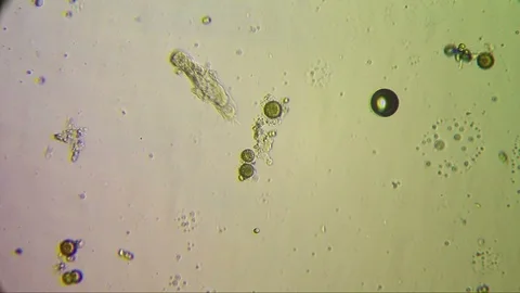 Chaetonotus SP Stock Footage 92421992