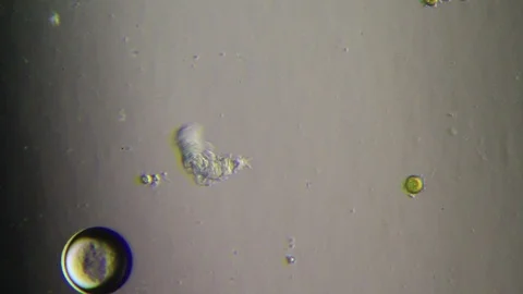 Chaetonotus SP Stock Footage 92422029