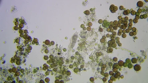 Chaetonotus SP Stock Footage 92422062