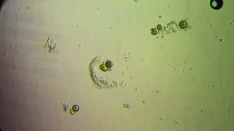 Chaetonotus SP Stock Footage 92422095