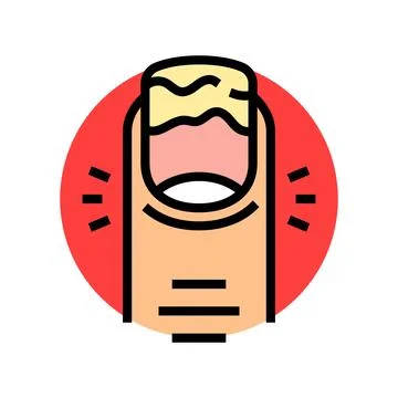 Changes nail appearance disease symptom color icon vector illustration Stock Illustration