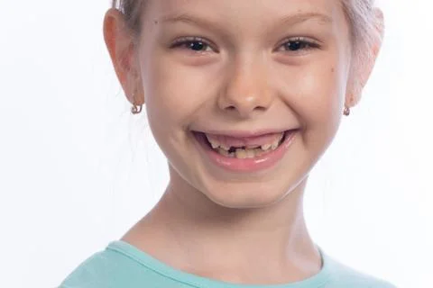 Changing Teeth Foto stock