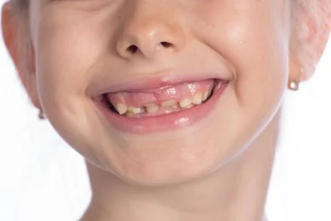 Changing Teeth Stock Photos