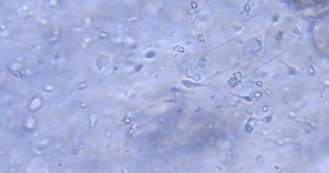 Chaotic movement of cells under a microscope Stock Footage 91398833
