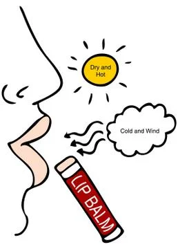 Chapped lips Stock Illustration
