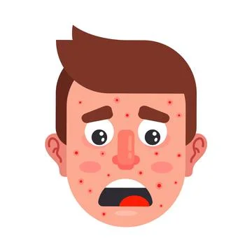Character with red pimples on his face. upset man with a drink. Stock Illustration