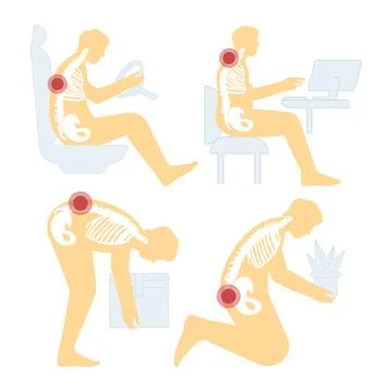 Character suffering from back pain set. Sore back muscles, wrong Stock Illustration