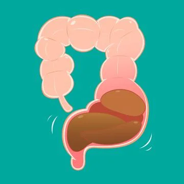 A charming illustration of intestines suffering from constipation. Stock Illustration
