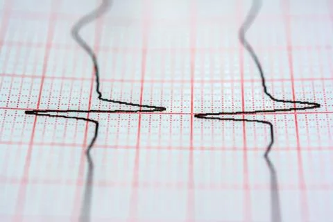 Chart background. Analytic concept. Stock Photos