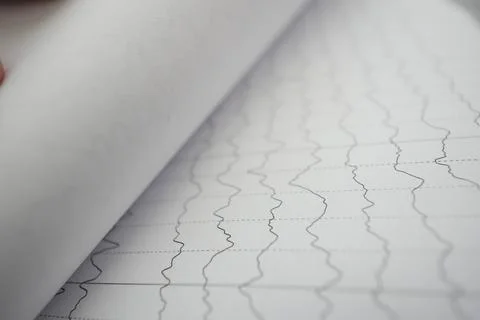 Charting medical data on unmarked graph paper Stock Photos