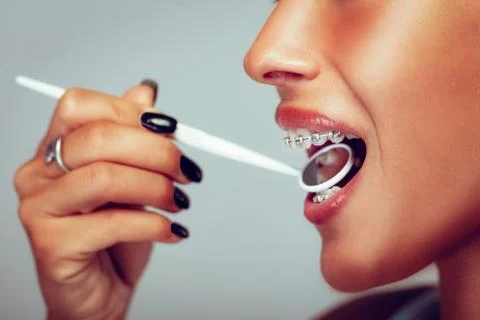 Checking Braces Stockfoto's