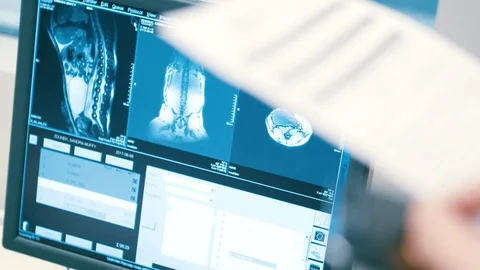 Checking a dog in an x-ray MRI scan for broken bones. Stock Footage 110774411