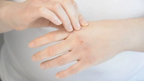 Checking the hand Vidéo 84300528