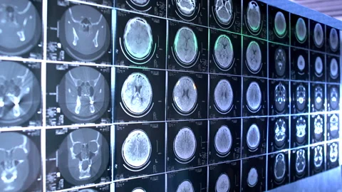Checking Mri Scan Stock Footage 210528118