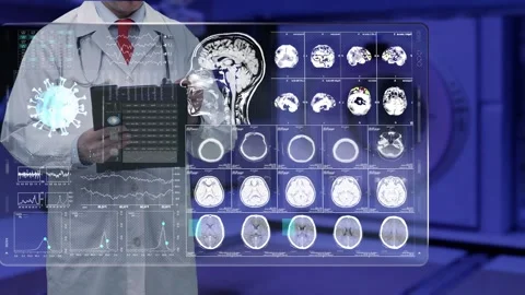 Checking MRI Tomography 4k Vídeo Stock 302543574