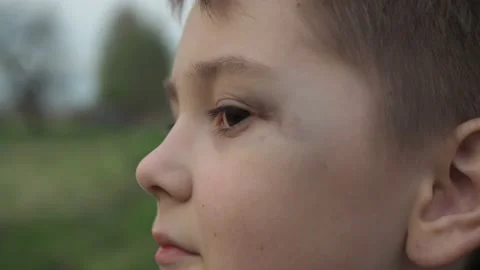 A cheeky boy with a black eye.the aftermath of the fight. at the end, he makes a Stock Footage 154125610