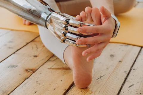 Cheerful woman with bionic arm does stretching exercises Stock Photos