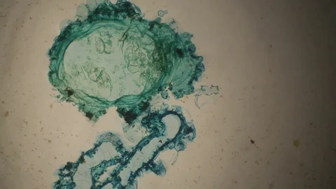 Chemical reaction under microscope Stock Footage 82548801