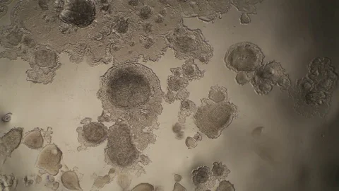 Chemical reaction under microscope Stock Footage 82549971