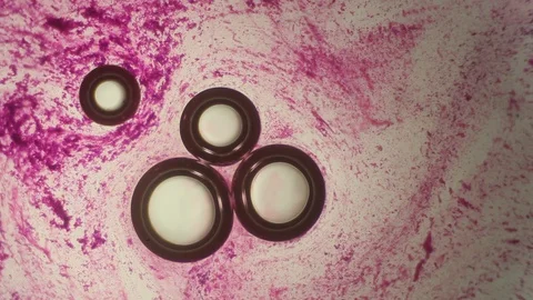 Chemical reaction under microscope Stock Footage 98546419