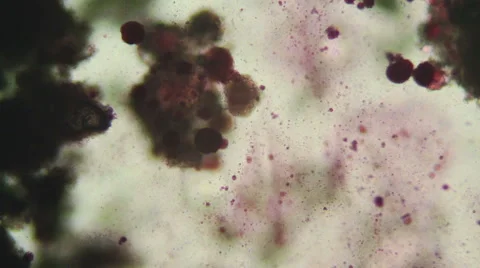 Chemical reactions under microscope Stock Footage 51538229