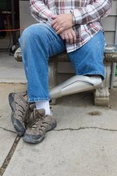 Chest down view of leg amputee sitting on bench with hands in lap Stock Photos