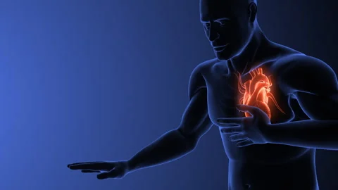 Chest pain or a heart attack Stock Footage 268941373