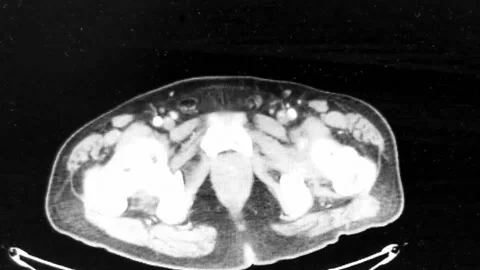 Chest to Toe CT Scan Video in HD Stock Footage 156711370