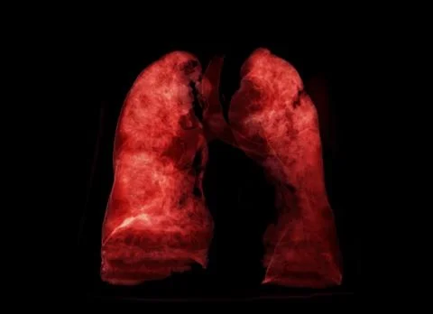 Chest X-ray with Lung 3D rendering image Stock Illustration