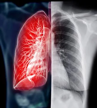 Chest X-ray with Lung 3D rendering  . Illustrazione stock
