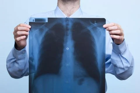 Chest x-ray Stock Photos