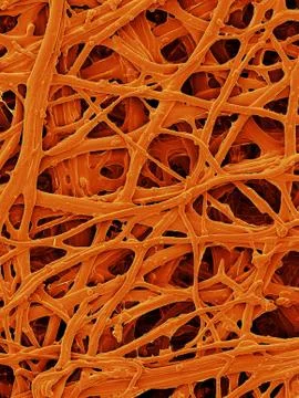 Chicken eggshell inner membrane, SEM Stock Photos
