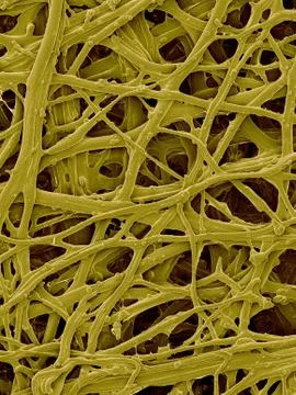 Chicken eggshell inner membrane, SEM Stock Photos