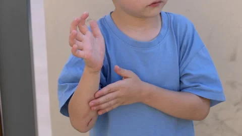 Child bends arm to look closely at fresh elbow scrape, examining redness and Stock Footage 321817387
