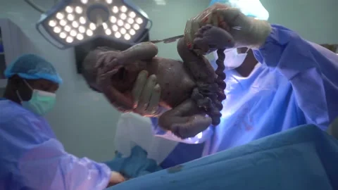 Child Birth Stock Footage 189496389
