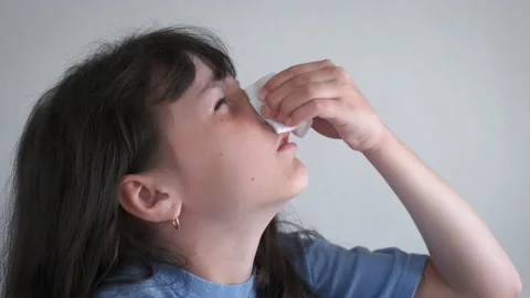 The child is bleeding from the nose. Stock Footage 231927484